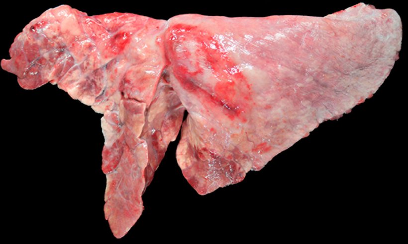Figure 5: Pig lung co-infected with M. hyopneumoniae and A. pleuropneumoniae. Cranioventral areas of consolidation with a reddish-brown color, caused by infection by M. hyopneumoniae, and an oval-shaped lesion with pleural fibrosis and hemorrhagic area in the diaphragmatic lobe, which would correspond to the chronical stage after an outbreak of necrosis caused by A. pleuropneumoniae.